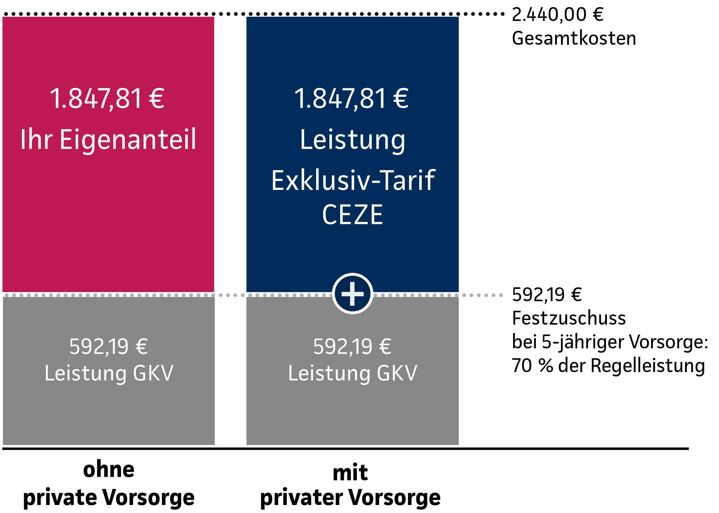 Grafik: Leistungsbeispiel - Kosten für Zahnersatz